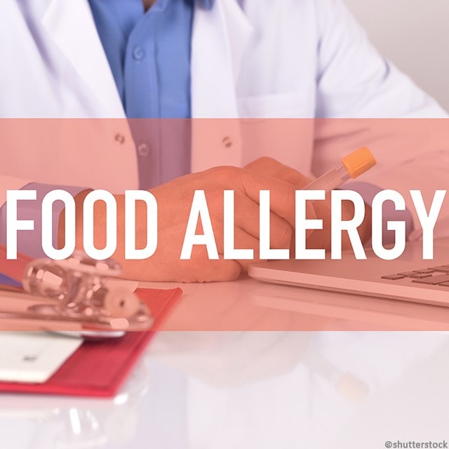食客安心守則:廚師一定要學的食物過敏反應 食客安心守則:廚師一定要學的食物過敏反應