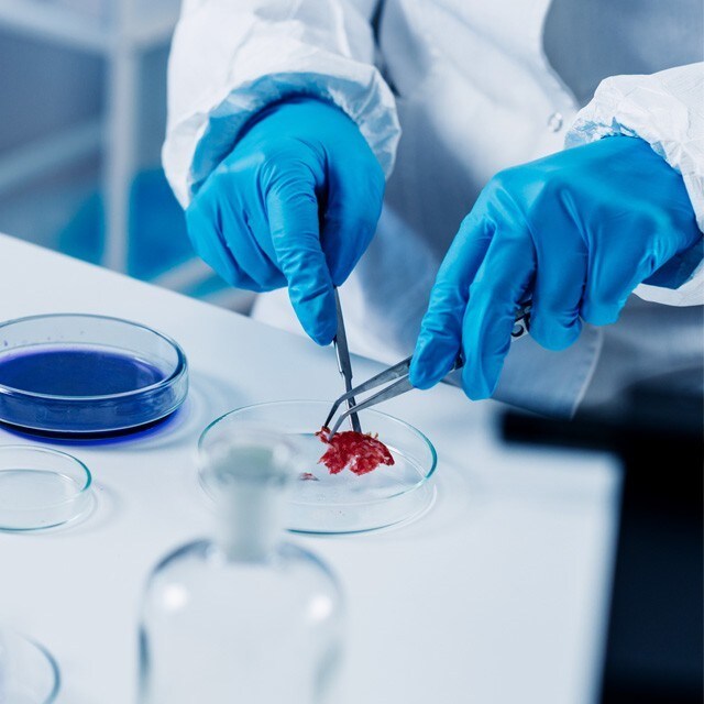 【食在新聞】食品病原菌列必檢項目，違者重罰